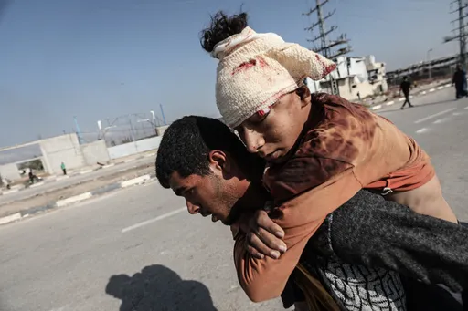 Dokter asing di Gaza gambarkan luka terburuk yang pernah mereka lihat