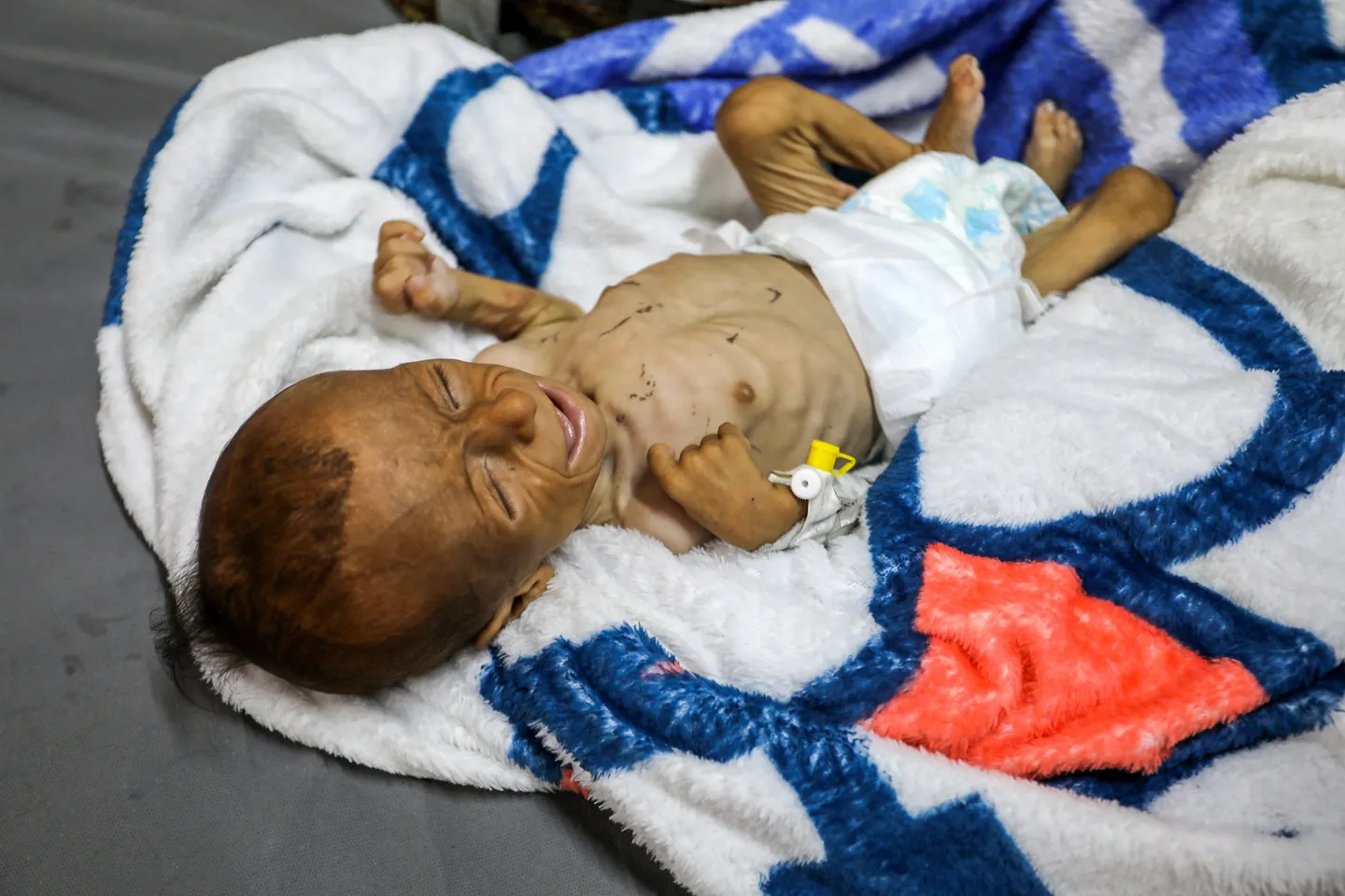 سازمان ملل: یک کودک از هر سه کودک در غزه در ۲۴ ساعت گذشته بدون غذا بوده‌اند