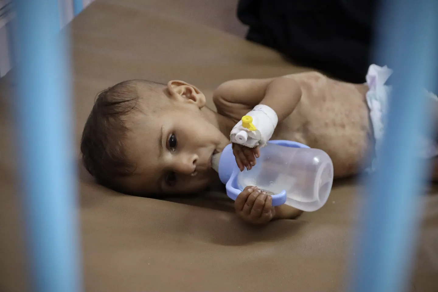 Fame imposta ai palestinesi di Gaza da Israele causa 
367 morti