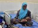 Fiye da kashi 35 na yaran Nijeriya na fama da rashin abinci mai gina jiki – NARD