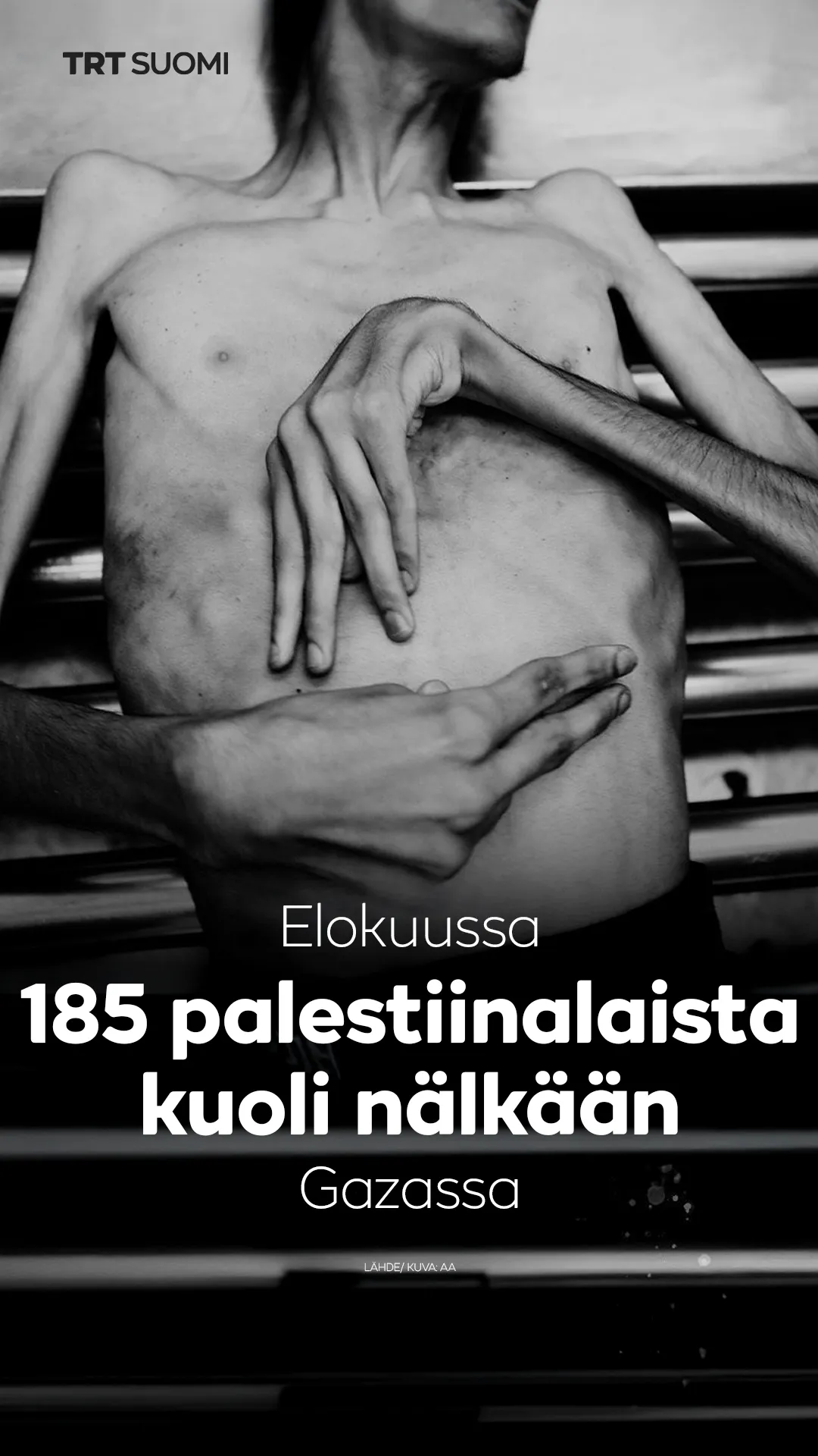 Israelin aiheuttama nälänhätä tappaa palestiinalaisia ​​ennätysvauhtia
