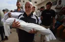 Gaza doctors reveal disturbing pattern of gunshot wounds in head, chest among children