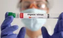 Mlipuko wa Mpox Afrika siyo suala la dharura duniani tena - WHO