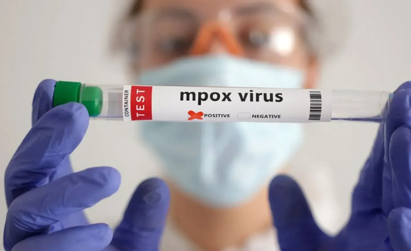 Mlipuko wa Mpox Afrika siyo suala la dharura duniani tena - WHO