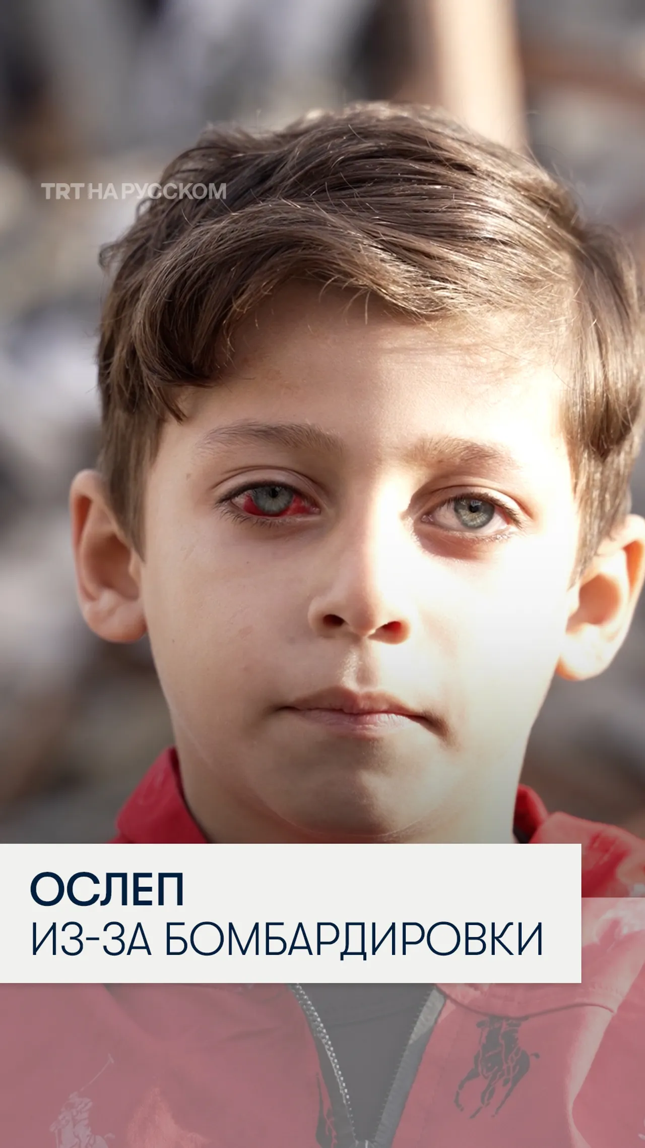 Мальчик из Газы ослеп на один глаз в результате израильской бомбардировки