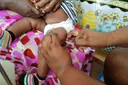 Afrique : la course contre la montre pour sauver l’anesthésie des enfants