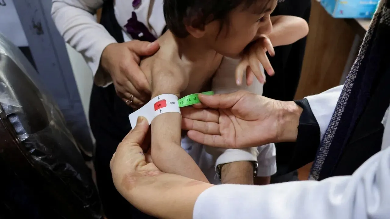 سازمان ملل: افغانستان برنامه ۱۰۰ میلیون دلاری امنیت غذایی را اجرا می‌کند