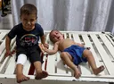 Romania offers to take in child patients from Gaza as Europe lags on medical evacuations