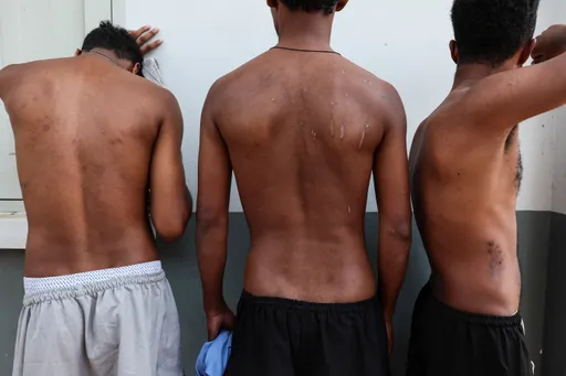 UN report details 'staggering' torture, abuse in global scam trafficking networks