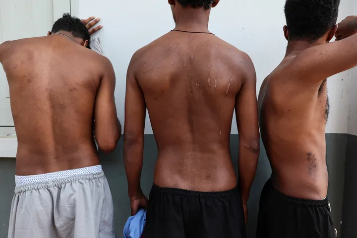 UN report details 'staggering' torture, abuse in global scam trafficking networks