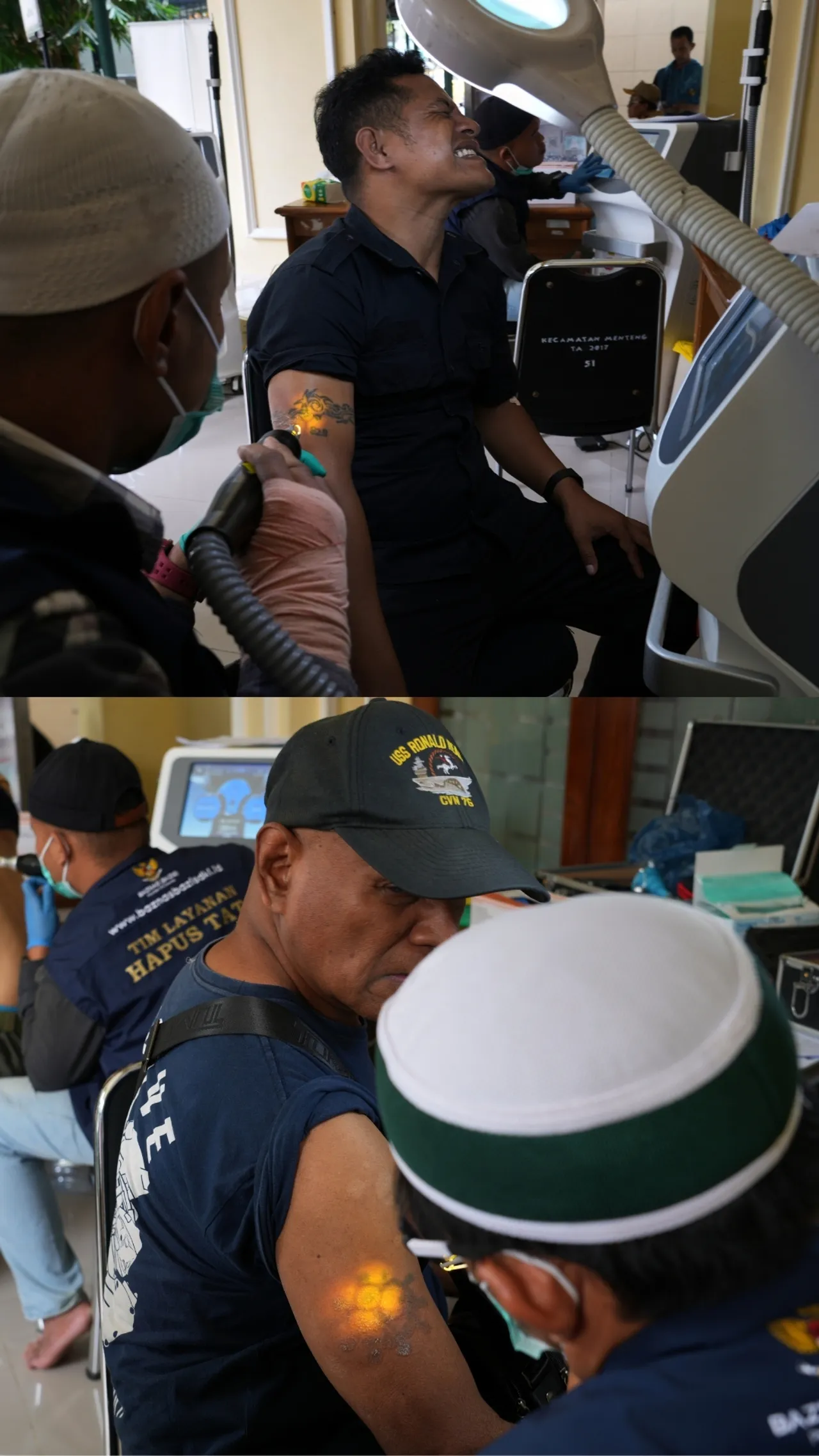 BAZNAS fasilitasi penghapusan tato gratis selama Ramadan