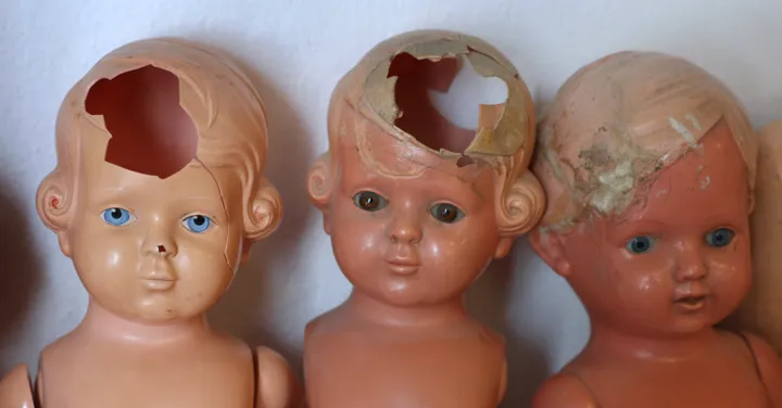 Kinderspital Zürich: Deutlicher Anstieg bei Kindesmisshandlungen