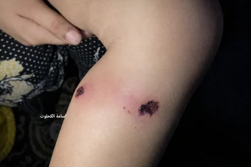 Israeli soldiers reportedly torture one-year-old child in Gaza to force confessions from his father