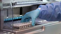 Togo yatoa uzoefu wa kupambana na magonjwa yasiyopewa kipaumbele