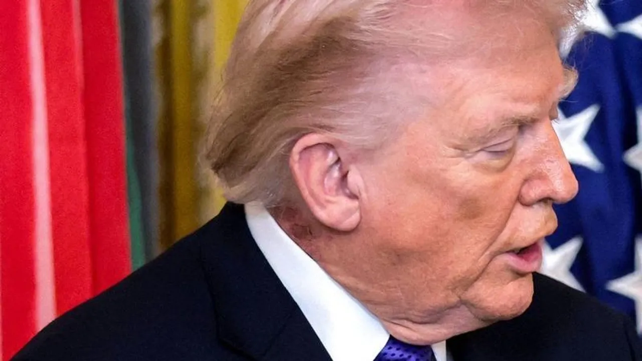 Trump says he needs to be personally involved in selecting Iran's new supreme leader