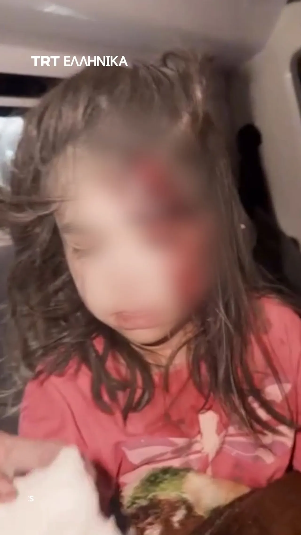 Η Ιρανική Ερυθρά Ημισέληνος ανάρτησε βίντεο των παιδιών που τραυματίστηκαν στις επιθέσεις ΗΠΑ-Ισραήλ