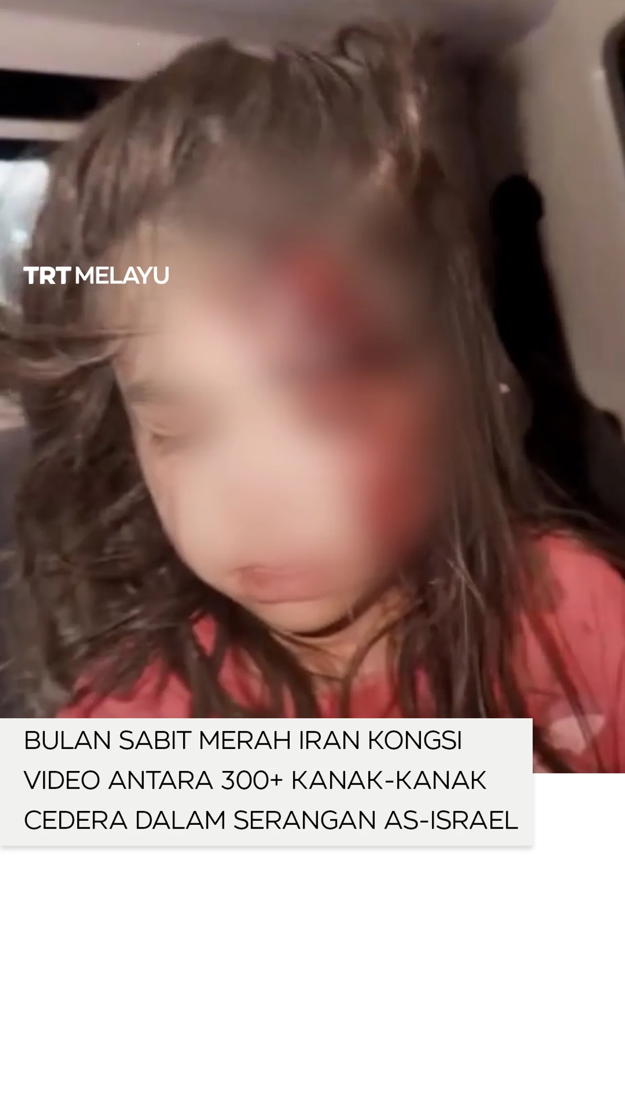 Bulan Sabit Merah Iran kongsi video antara 300+ kanak-kanak cedera dalam serangan AS-Israel
