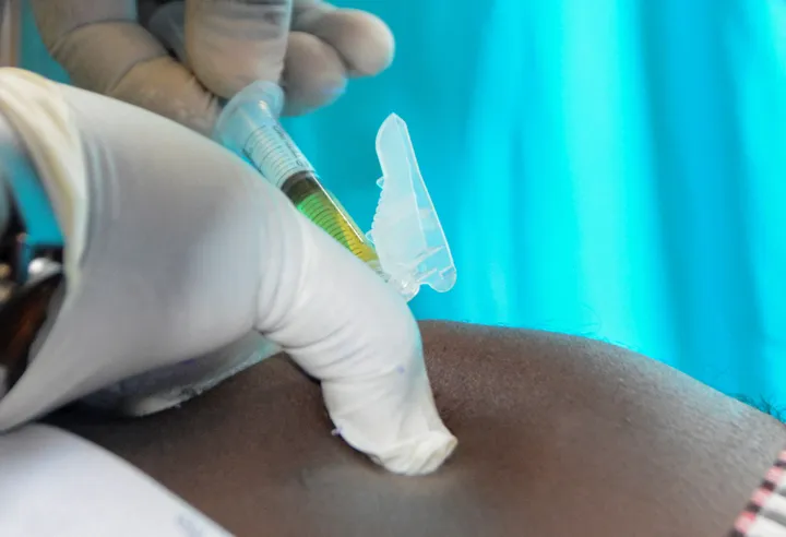 Le inezioni dimagranti