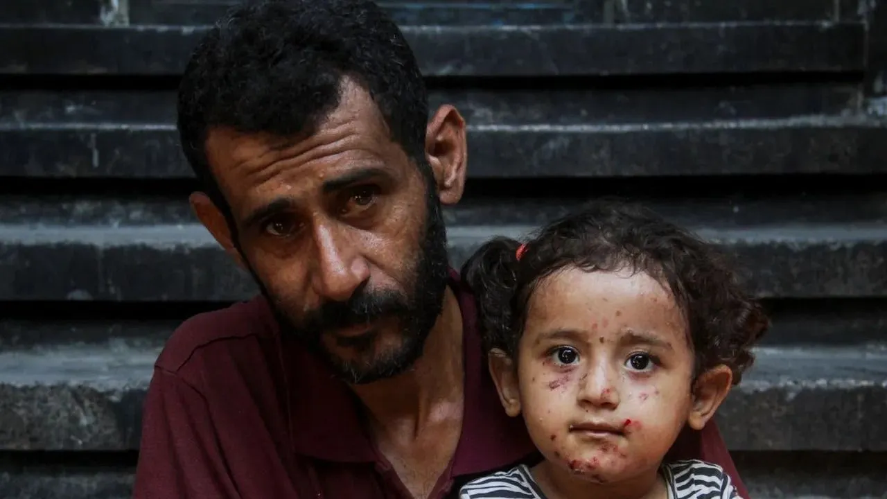 سازمان ملل: عفونت‌های پوستی در میان آوارگان غزه بیش از سه برابر شده است