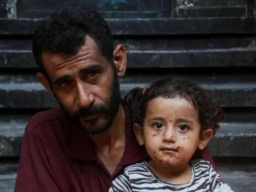 سازمان ملل: عفونت‌های پوستی در میان آوارگان غزه بیش از سه برابر شده است