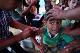 Bangladesh melaporkan hampir 100 kematian anak dalam dugaan wabah campak