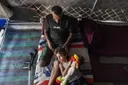 OBSh-ja: 43.000 njerëz në Gaza kanë pësuar lëndime që ua kanë ndryshuar jetën që nga viti 2023