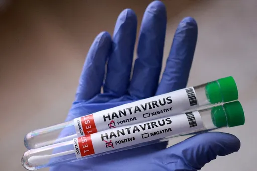 Jakarta pantau 3 kasus positif dan 6 suspek hantavirus