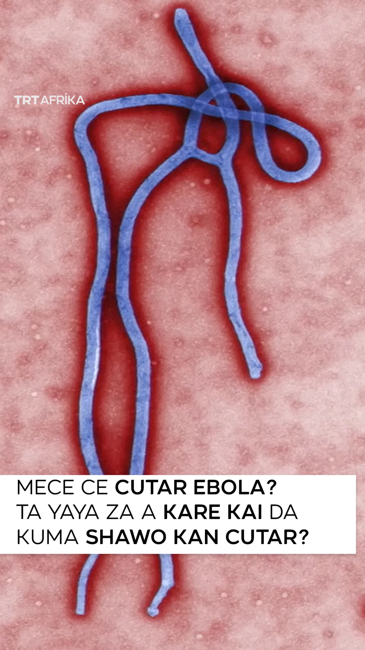 Mece ce cutar Ebola? Ta yayya za a kare kai da kuma shawo kan cutar?