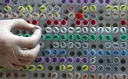 Embryos in a suitcase: New case revives stink over Israel-linked organ trafficking networks