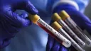 Thailand orders 21-day mandatory Ebola quarantine for DRC, Uganda arrivals