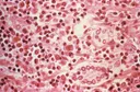 WHO ta ce duniya ba ta fuskantar barazana bayan ɓullar cutar hantavirus a wani babban jirgin ruwa
