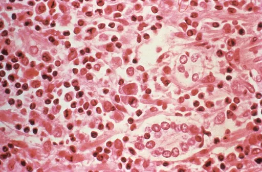 WHO ta ce duniya ba ta fuskantar barazana bayan ɓullar cutar hantavirus a wani babban jirgin ruwa