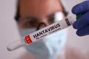 South Africa monitors four possible hantavirus contacts in Cape Town