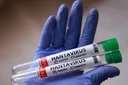 Argentina accuses WHO of 'politicising' hantavirus outbreak as cases surge