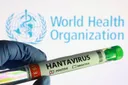 OMS: Al momento valutiamo il rischio rappresentato dall'hantavirus per la popolazione globale come basso