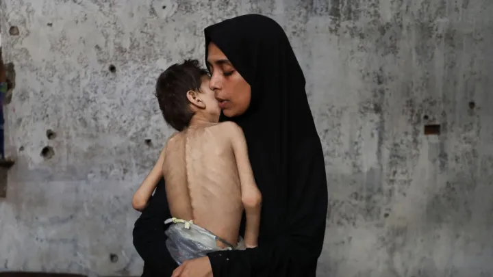 Comment Israël a-t-il fabriqué une crise de malnutrition à Gaza?