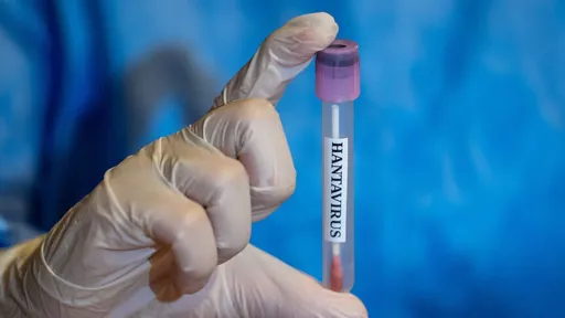 SZO: Negativan test stjuardese na hantavirus ublažava strahove od širenja virusa