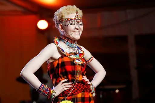 From survival to success: Why the conversation on albinism is changing