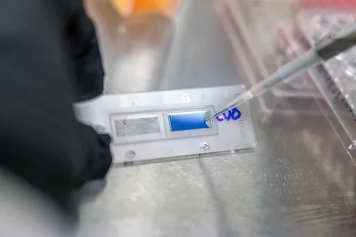 Roche objavio uspješno ključno ispitivanje eksperimentalnog lijeka za rak pluća