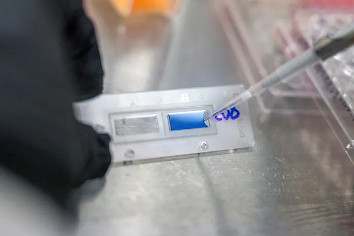 Roche objavio uspješno ključno ispitivanje eksperimentalnog lijeka za rak pluća