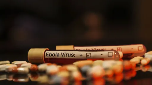 DRC Ebola contact tracing falls far short as outbreak spreads, Africa CDC chief says