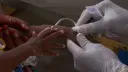 Diphtheria outbreak kills 31 people in Nigeria's Plateau state