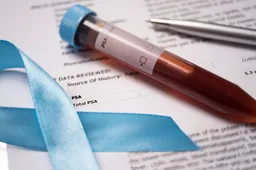 U Hrvatskoj od raka prostate godišnje umre oko 800 muškaraca