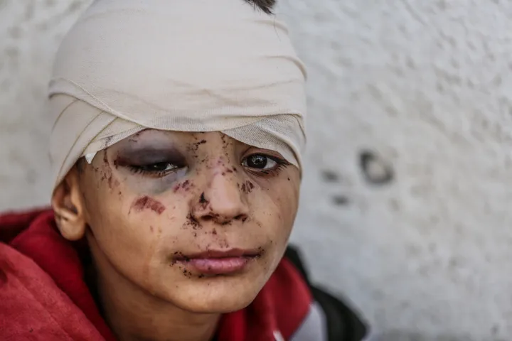 Gaza: une guerre contre les enfants, déjà 16 503 morts