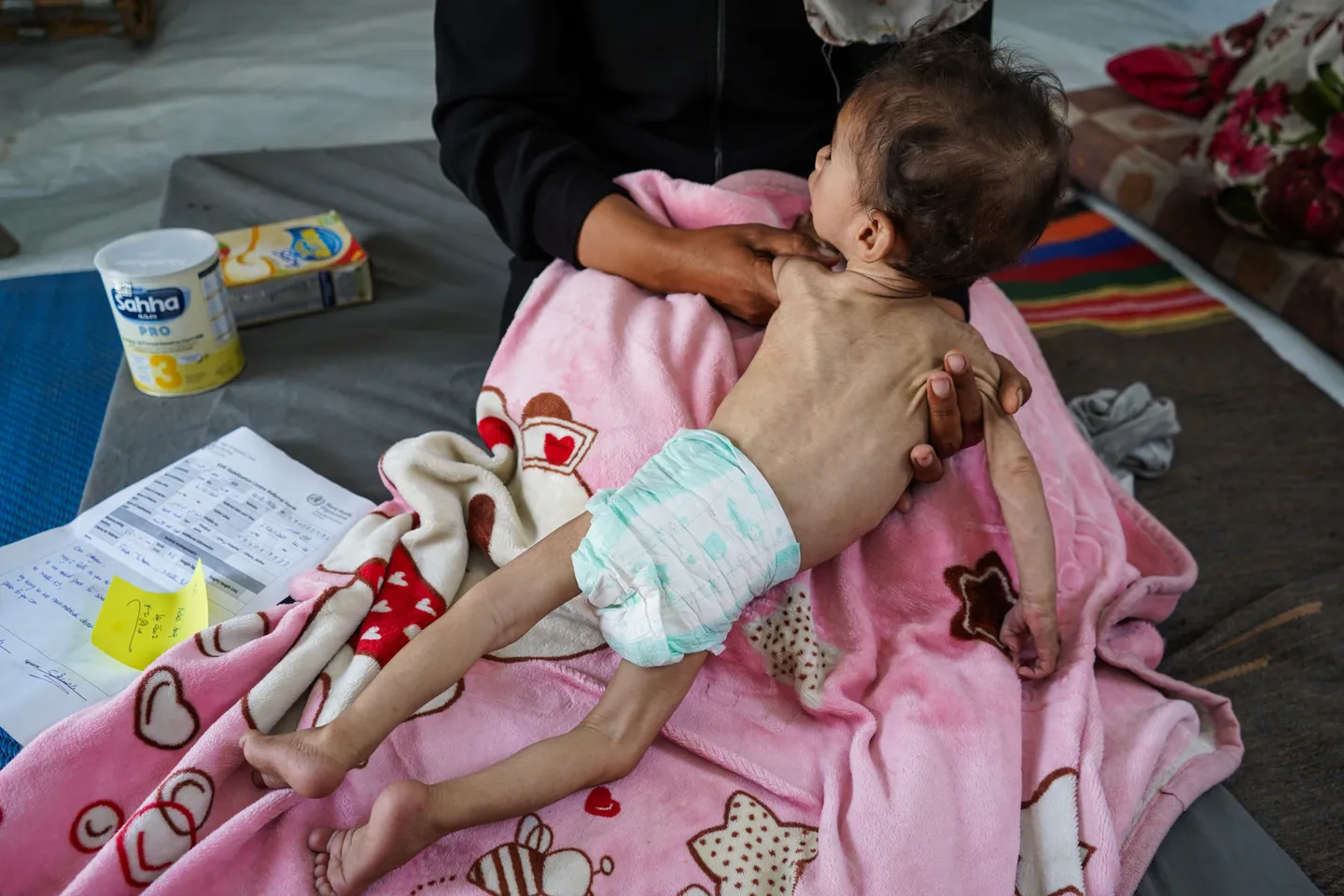 Një fëmijë vdes nga uria në Gaza mes bllokadës izraelite