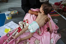 Një fëmijë vdes nga uria në Gaza mes bllokadës izraelite