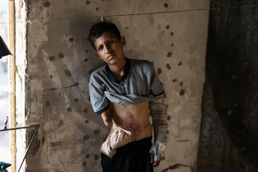 Death trap for Gaza children: How Israel is blocking medical evacuation by increasing red tape