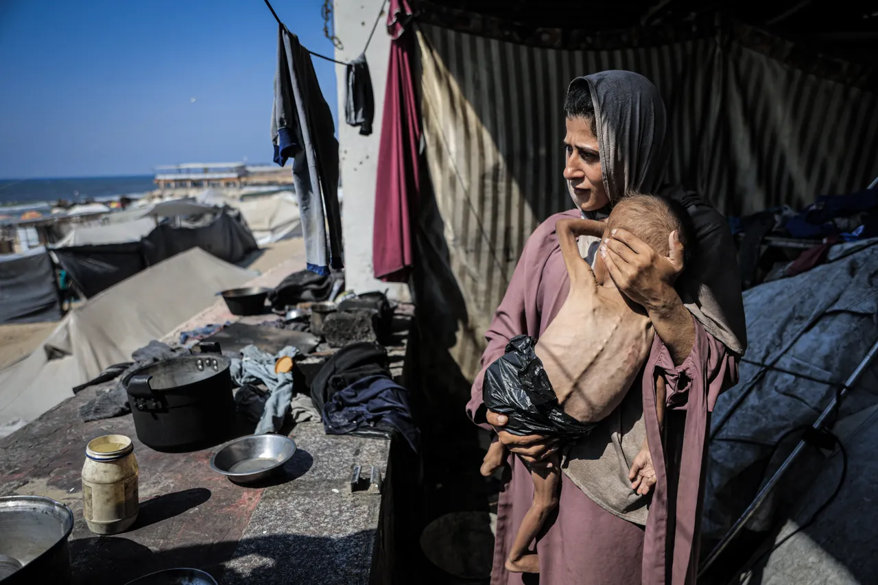 ¿Cómo fabricó Israel una crisis de desnutrición en Gaza?