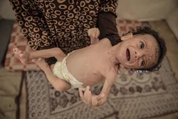 Israel's 'suffocating' blockade puts over 40,000 Gaza infants in cradle of death