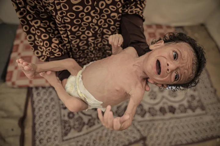 Israel's 'suffocating' blockade puts over 40,000 Gaza infants in cradle of death